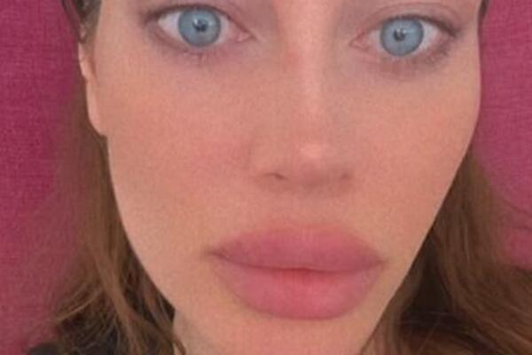 Vanzemaljske oči, džinovske usne, a čelo... Amidžićeva žena objavila šok sliku, komentari samo pljušte