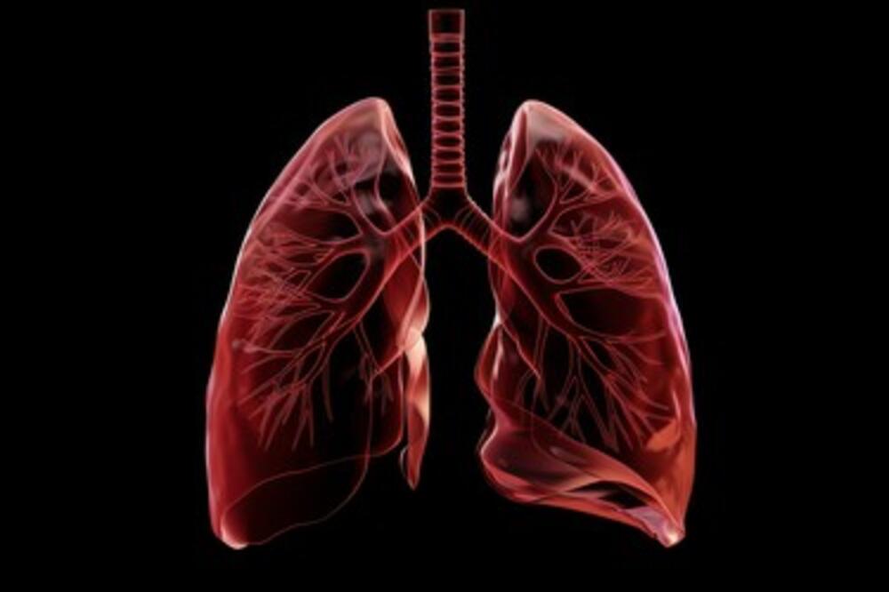 Kako se postavlja dijagnoza raka pluća? Doktorka otkriva ključne korake, ovo su simptomi