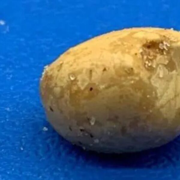 Svi na ovoj slici vide krompir pored šrafa, ali...Frapiraju se kad shvate šta je to ustvari, au, ljudi (FOTO)