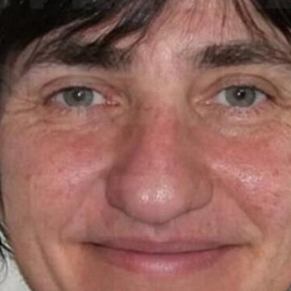 Ipak može od "babe devojka": Žena sa slike postala 20 godina mlađa za samo 86 dana, ako imaš pare sve može