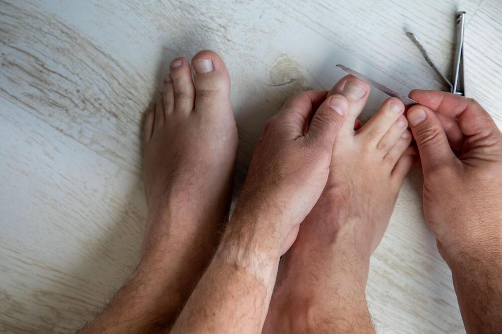 KAKO DA REŠITE PROBLEM URASLIH NOKTIJU? Osetite olakšanje na OVAJ način!