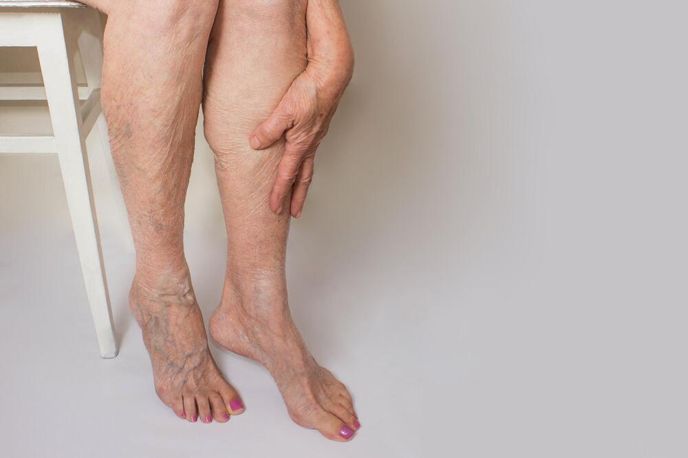 Doktori upozoravaju na ovo, a malo ko ih sluša: 7 skrivenih simptoma blokiranih vena za koje narod ne zna, šok