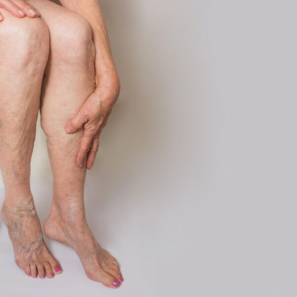 Doktori upozoravaju na ovo, a malo ko ih sluša: 7 skrivenih simptoma blokiranih vena za koje narod ne zna, šok