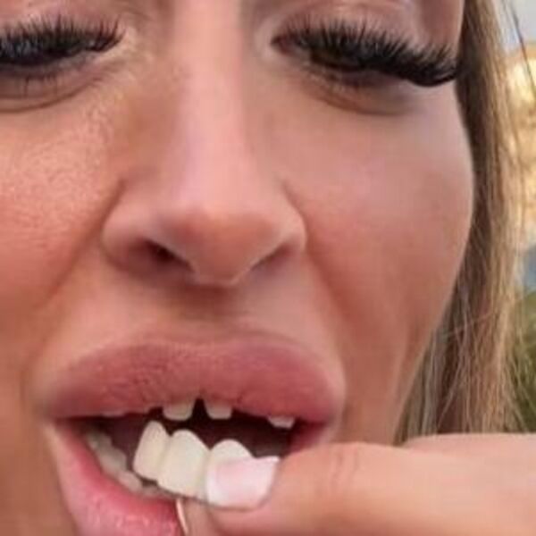 Majko sveta, kakva katastrofa! Zubi koštali &bdquo;kao Svetog Petra kajgana&ldquo;, a onda se zabezeknula na ulici, da poludi
