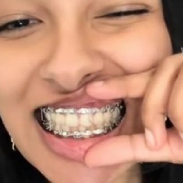 Majko sveta, pa kako ovo? Nagrabusila i završila u bolnici zbog slatkiša, nedeljama nije mogla da otvori usta