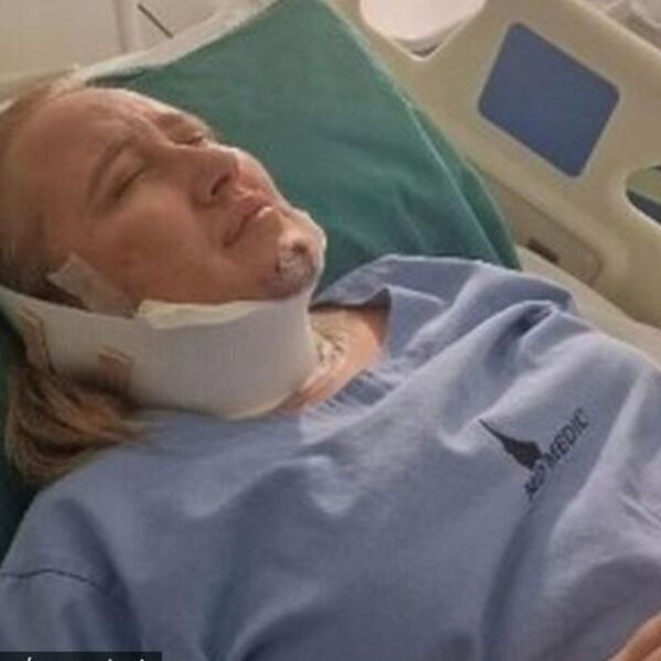 Kristina Karić sva u podlivima i modricama! Jeziva slika iz bolnice kruži mrežama