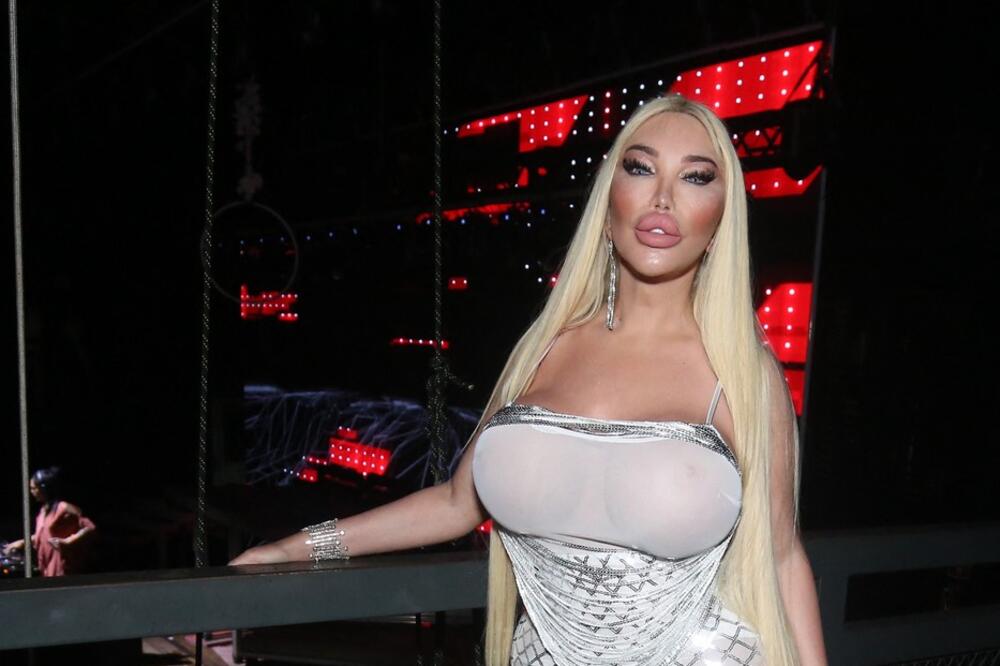 Srbi ga pamte kao zgodnog plavušana sa velikim usnama, a sada je žena sa silikonima: Ni majka rođena da ga prepozna