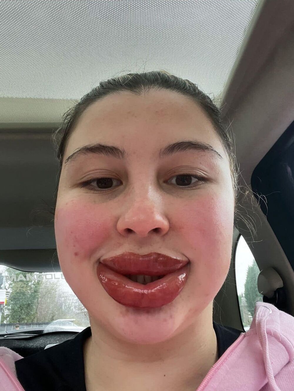 I dok su joj pratioci na društvenim mrežama savetovali da hitno ode kod lekara, ona nije paničila.