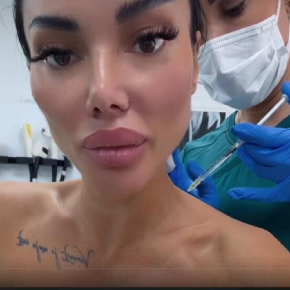 "KO NEMA VRAT NEKA...": Starleta uradila 100 operacija, a sada ŠOKIRALA NOVIM ZAHVATOM! Prizor zgranuo Srbe