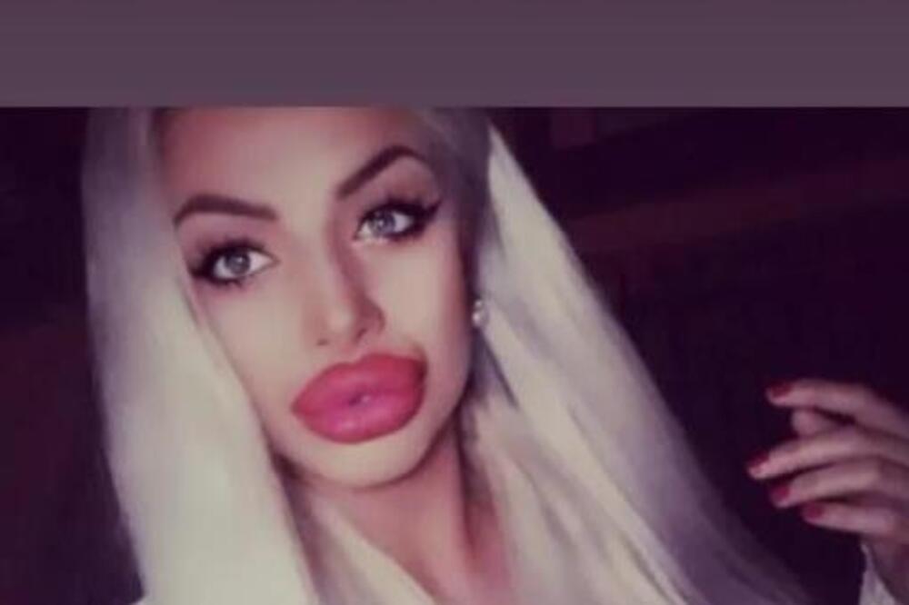 Isplivale šok slike animir dame iz Švajcarske! Plava kosa i prepumpana usta, da li je moguće da je to ona?