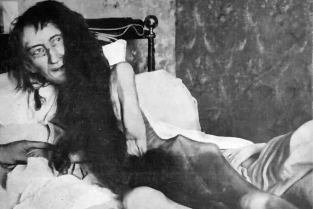 „Najstrašnija fotografija na svetu“ na kojoj žena leži u krevetu krije još strašniju istinu: Blanš Monije je...