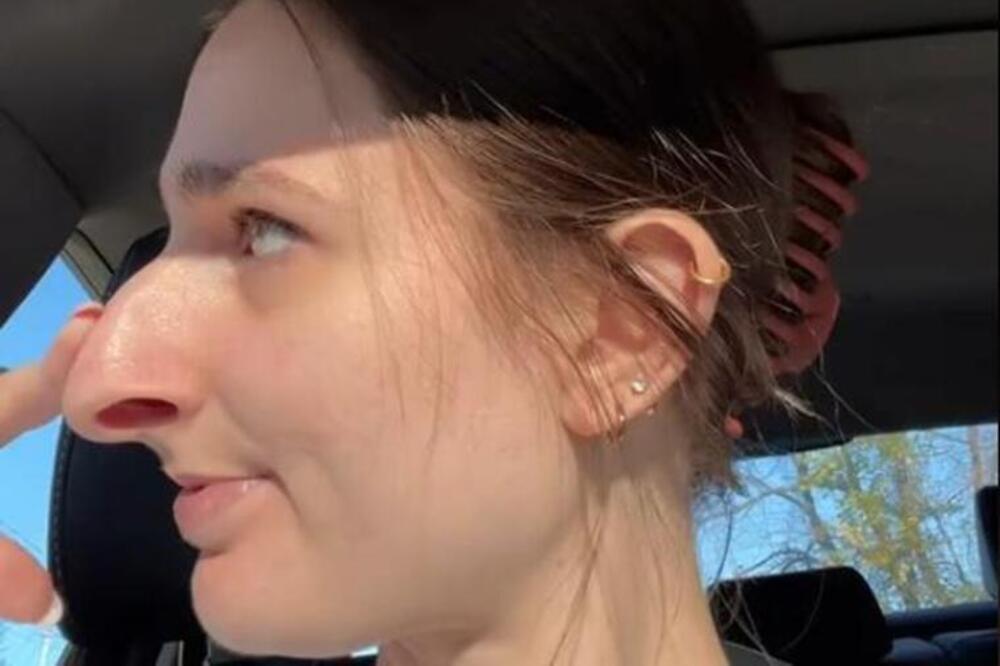 Zbog nosa je vređali, govorili da je odvratna: Zainatila se, operisla se, odradila svašta i sada je RIBETINA