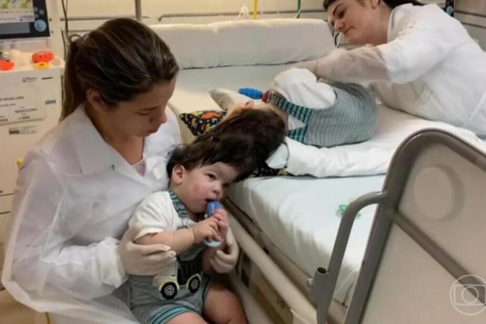 Rođeni su sa spojenim lobanjama, ceo život roditelji maštali o razdvajanju mozga: Kada se to desilo, od šoka...