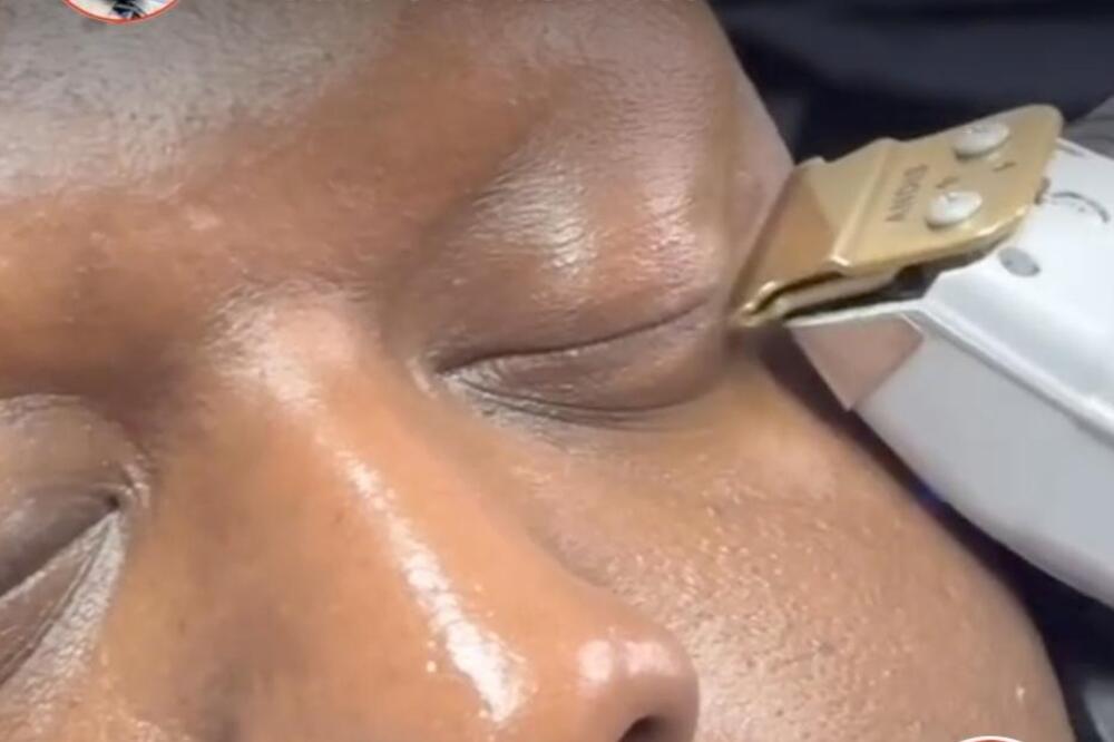 Da li je moguće da i ovo rade? Ljudi masovno briju trepavice, a ovo je razlog, ostaćete bez teksta