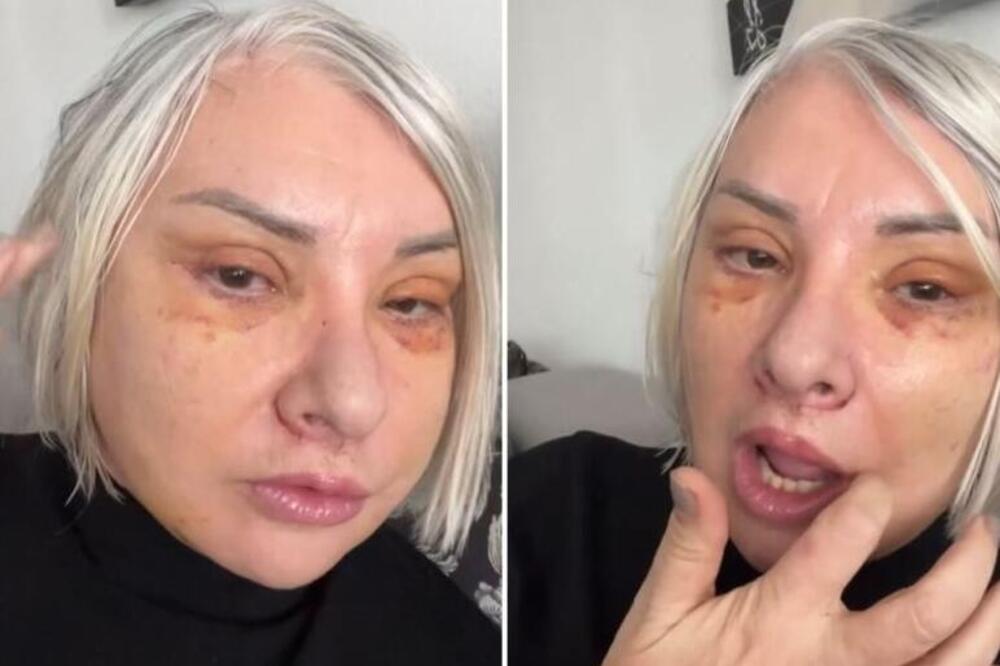 Znate ko je na fotografiji? Danijela (58) išla pod nož i zategla lice, a narod se zabezeknuo - postala druga žena
