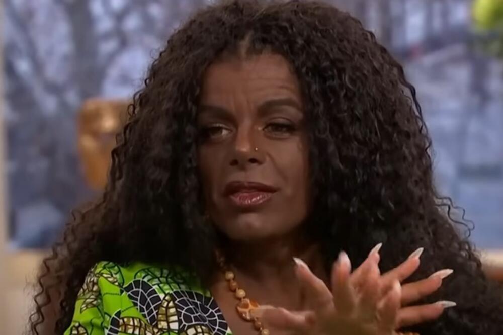 Ona ima najveće grudi u Evropi, a čekajte da vidite kako je izgledala pre operacija: Nećete verovati svojim očima