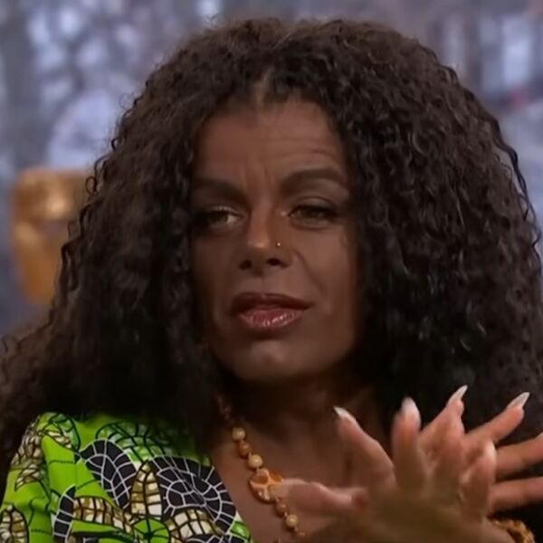 Ona ima najveće grudi u Evropi, a čekajte da vidite kako je izgledala pre operacija: Nećete verovati svojim očima