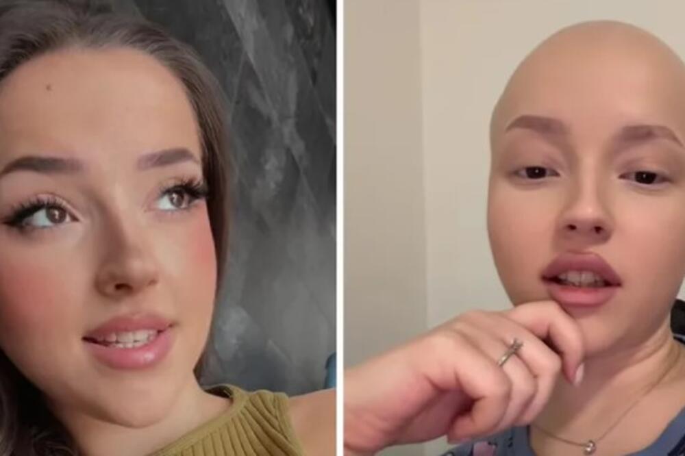 Emilia je pobedila najstrašnijeg neprijatelja! Više nema malignog tumora - sa 21 godinom mnogo toga je prošla!