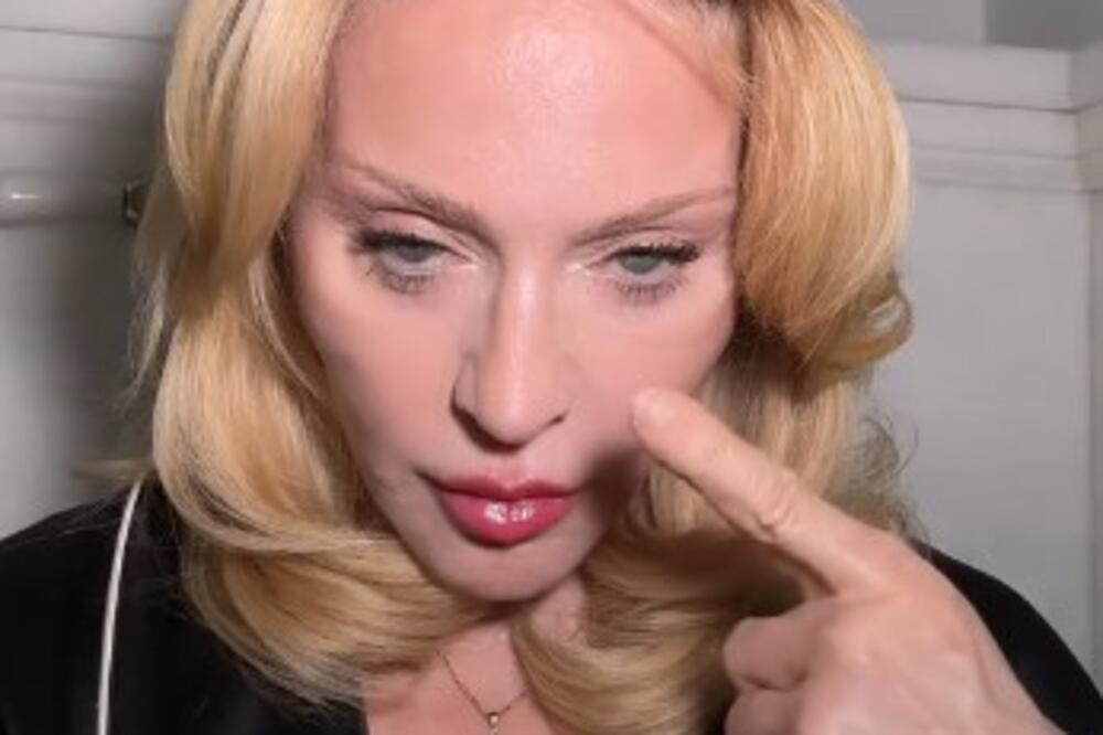 "Jednog dana sam živa, sledećeg NA SAMRTI": Srbi se SEPSE plaše kao đavola, a evo kako se izlečila Madona