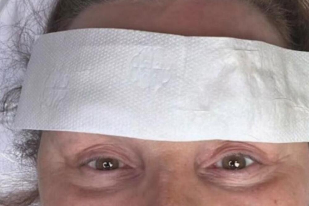 Ana Bekuta završila na bolničkom stolu! Zavijeno joj pola glave