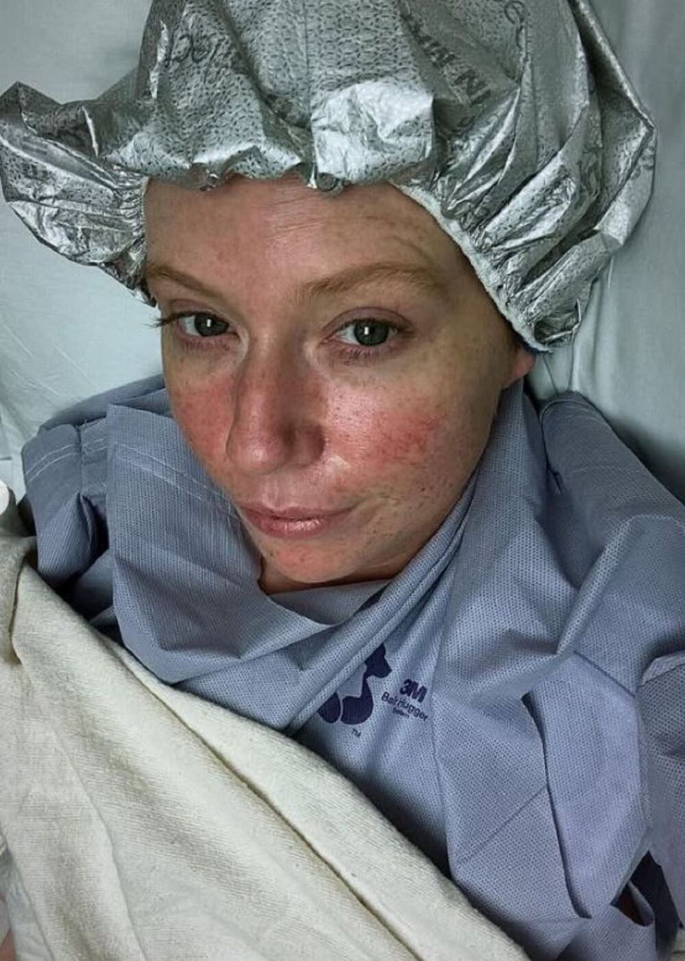 Rak jezika, Bet Rile