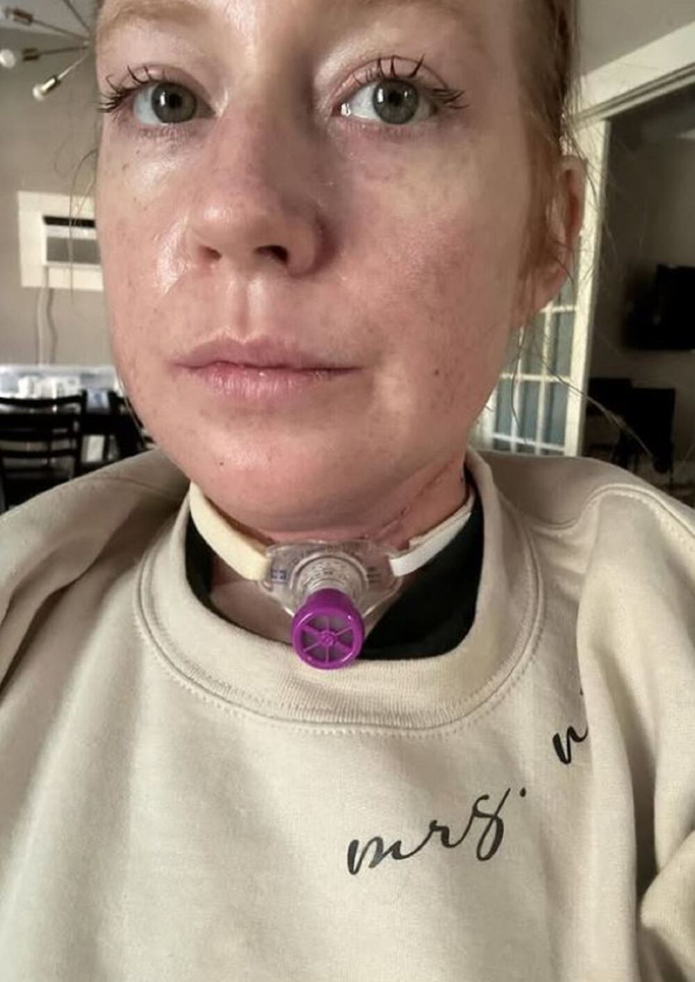 Rak jezika, Bet Rile