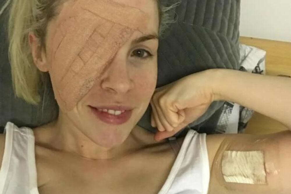 Imala tačkicu na kapku, a onda protrljala oko i odvojila kožu... Nije videla simptome pa otkrila strašnu dijagnozu