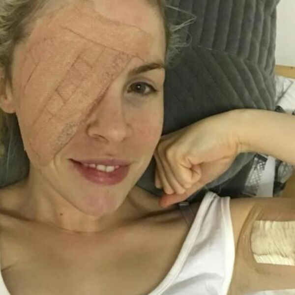 Imala tačkicu na kapku, a onda protrljala oko i odvojila kožu... Nije videla simptome pa otkrila strašnu dijagnozu