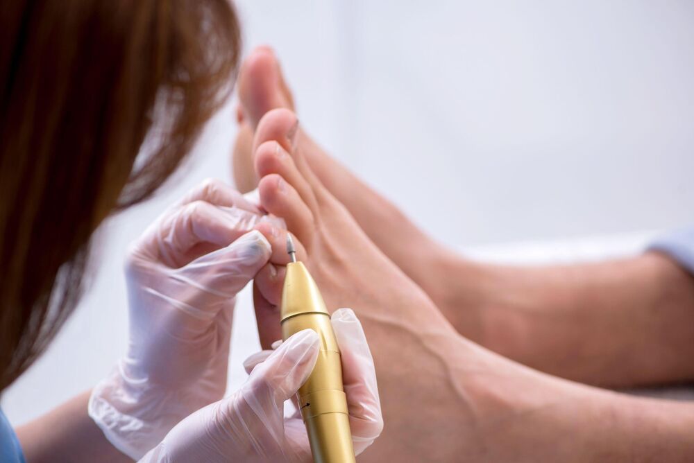 Nokti, Stopala, Pedikir