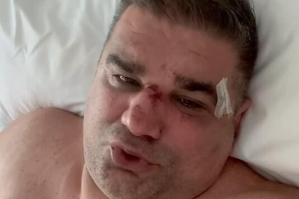 Zagrebačka policija se oglasila zbog prebijanja Saše Mirkovića