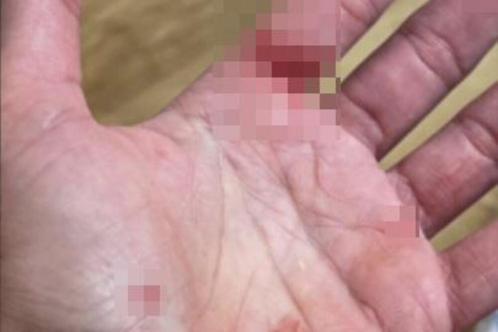 Nakon krvavih slika nasilja, oglasila se Vendi! Stala u odbranu ovog muškarca, a nju urnisala rečima