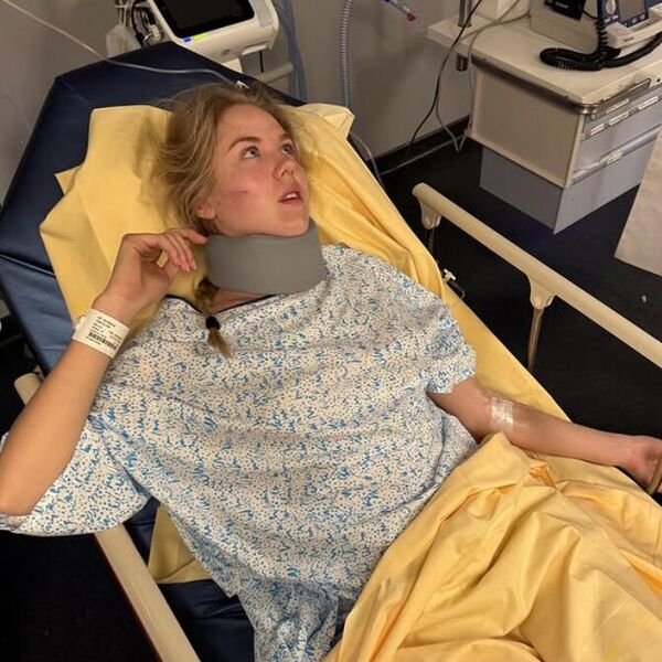 Glavom udarila u zid, reanimirali je! Potresne slike princeze Marije nakon teške saobraćajke!