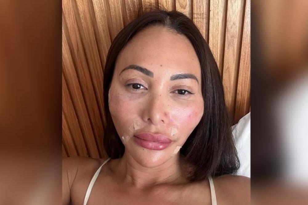 Porodila se pa krenula sa korekcijama: Dala ogromnu cifru da ima žestoko telo - ni kredit ni čekovi ovde ne pomažu