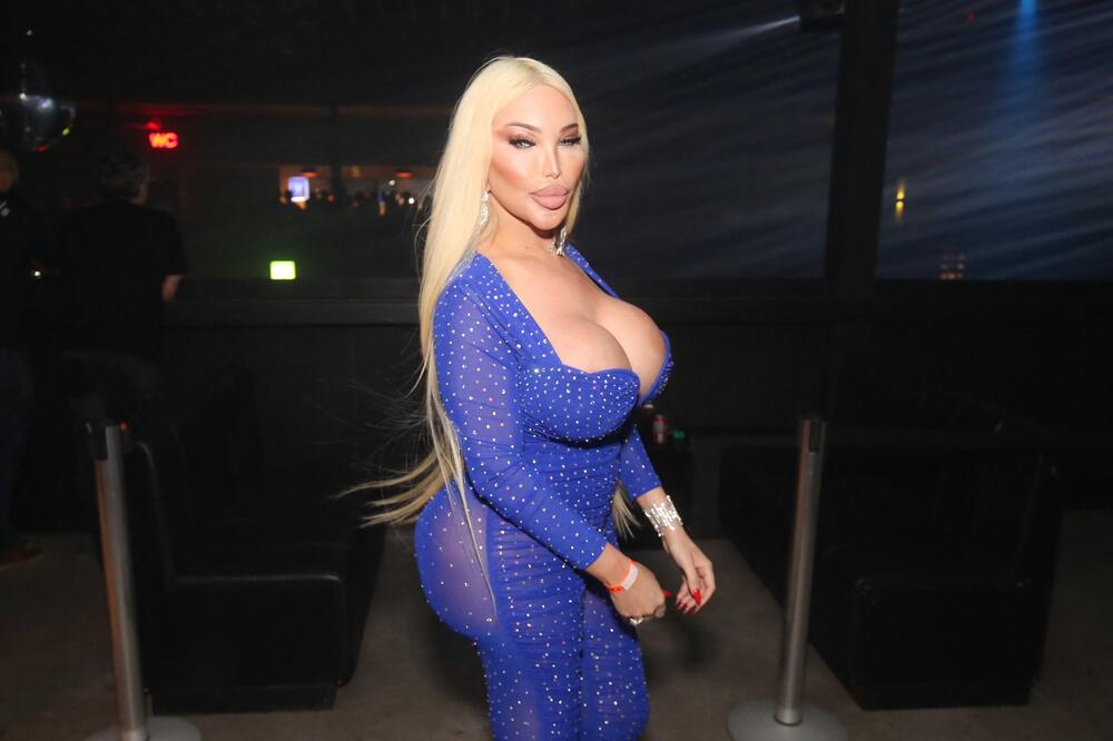 Zbog silnih operacija izgubila čulo mirisa, ali nije odustala: Da bi postao Barbika, Ken dao milione! (FOTO)