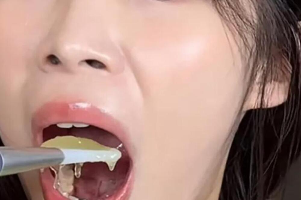 Poznata influenserka iznenada umrla u 24. godini: Postala poznata zbog bizarnosti koju je radila pred svima (FOTO)