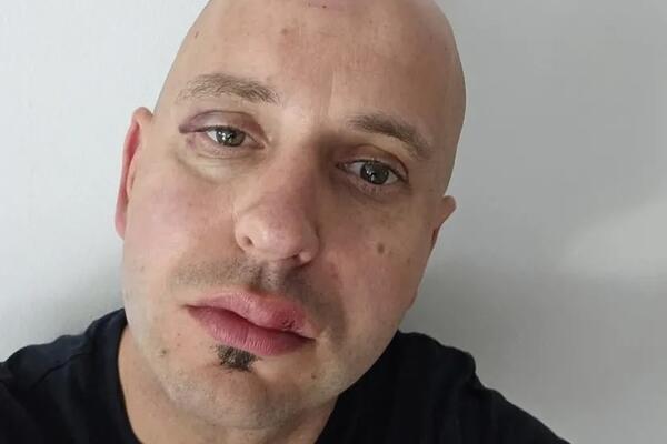 Brutalno pretučen gradonačelnik Ribnice