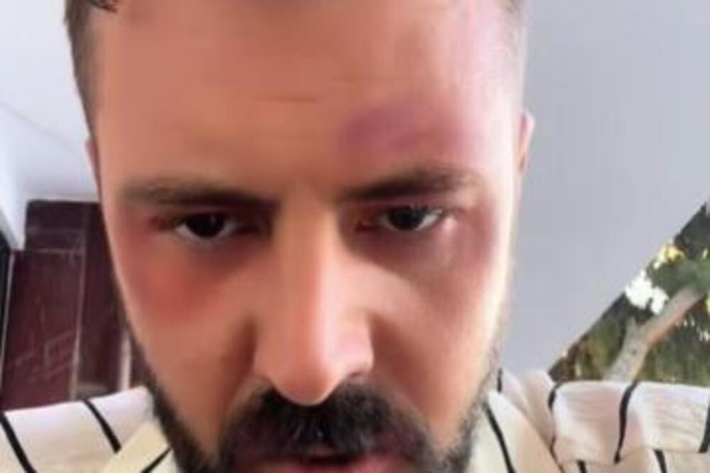 Pretučen Goran Vujičić: Moli za pomoć, njegove reči odzvanjaju