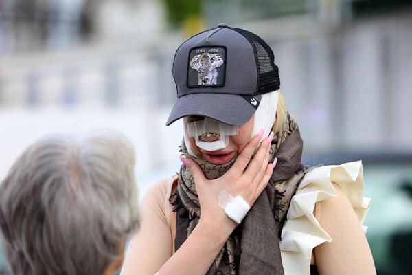 "AKO I TO NE USPE..." VODITELJKA PINKA IDE PO 7. PUT POD NOŽ - nos joj se URUŠIO NA STRANU