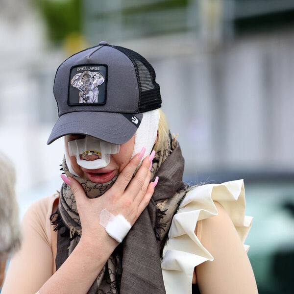 "AKO I TO NE USPE..." VODITELJKA PINKA IDE PO 7. PUT POD NOŽ - nos joj se URUŠIO NA STRANU