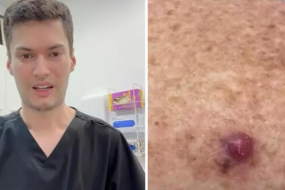 Ako ovo imate TRČITE kod doktora! Lekar hitno snimio i pustio upozorenje: Srbi, nema šale ako je tvrd, izdignut i..