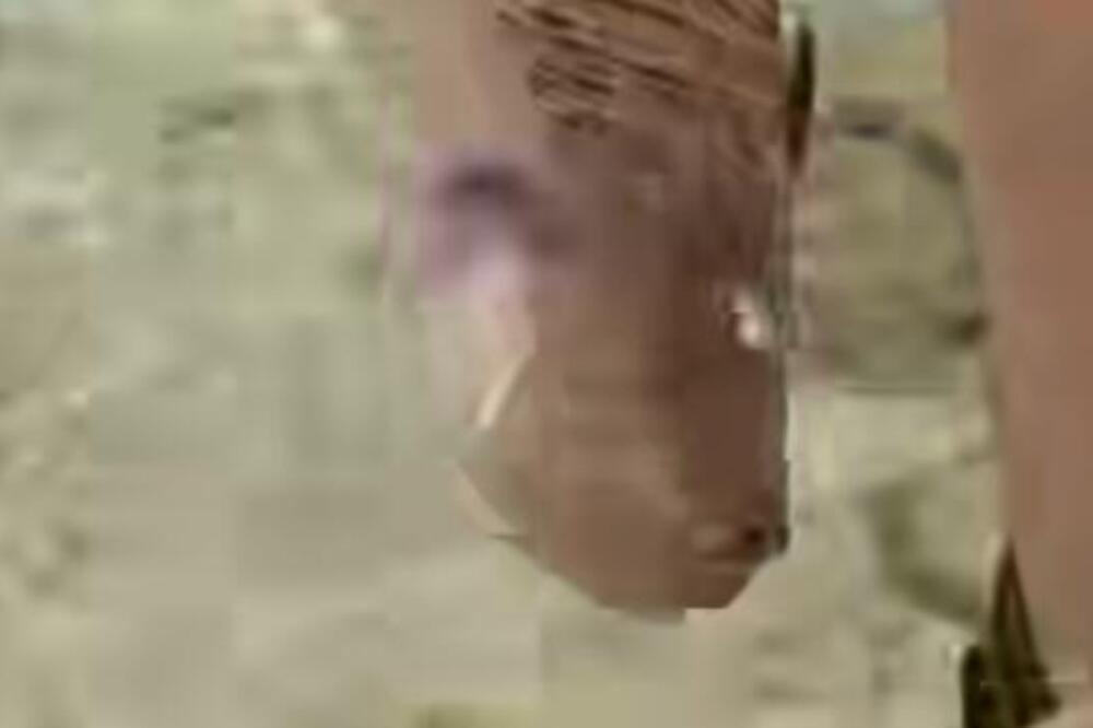 "ČUDO DA SE NISAM ONESVESTILA OD BOLA" Ovo je NAJOPASNIJE STVORENJE na Jadranu: "Znači, ako te sa ovim ubode..."