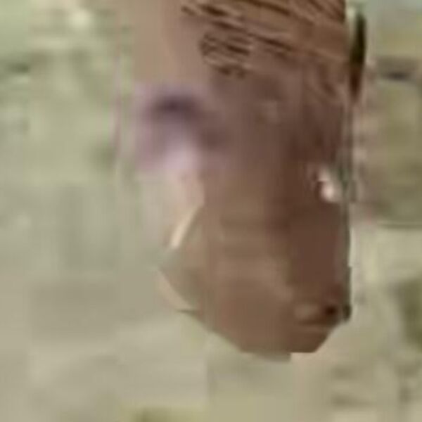 "ČUDO DA SE NISAM ONESVESTILA OD BOLA" Ovo je NAJOPASNIJE STVORENJE na Jadranu: "Znači, ako te sa ovim ubode..."