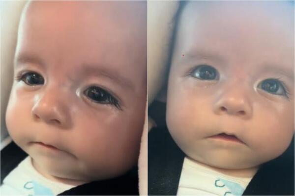 Ovako izgleda najtužnija beba na svetu! Dobro pogledajte njeno lice - majke i lekari ostali u čudu!