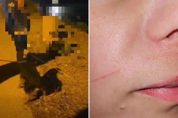 Turistkinja se provela kao "bosa po trnju" na hrvatskom ostrvu: Upala u BOLESNU ZAMKU na putu! (VIDEO)