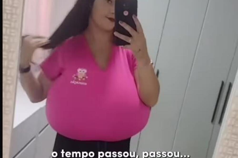 Njoj grudi ne prestaju da rastu! Svakog meseca se uvećaju po 700 grama, a razlog je šokantan