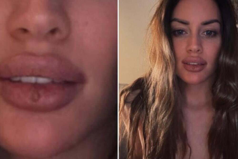 Ovo je dokaz da Ognjenova Mina nije prirodna? Ljudi gledaju u usta i ne veruju - "ŠTA JE OVO"