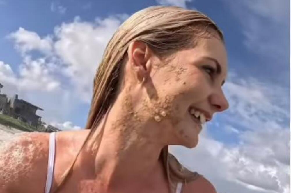 Kupala se u okeanu, a onda je osetila... Kad vidite o kakvoj gadosti se radi zgadiće vam se sve! (VIDEO)