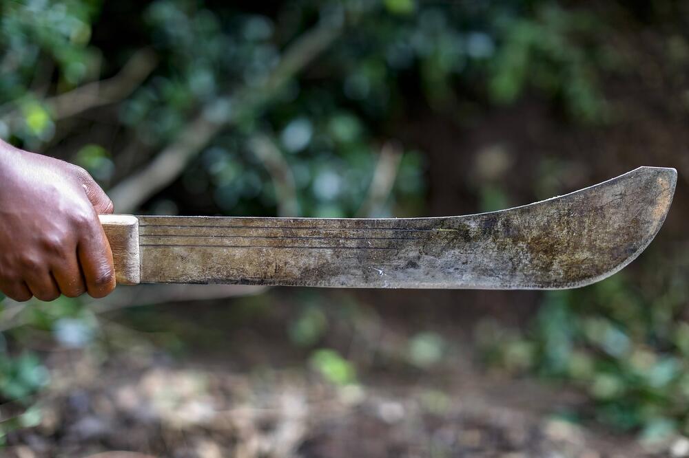 Horor kod Mionice: Dečko mačetom isekao policajca i naneo mu stravične povrede, čovek može da umre!