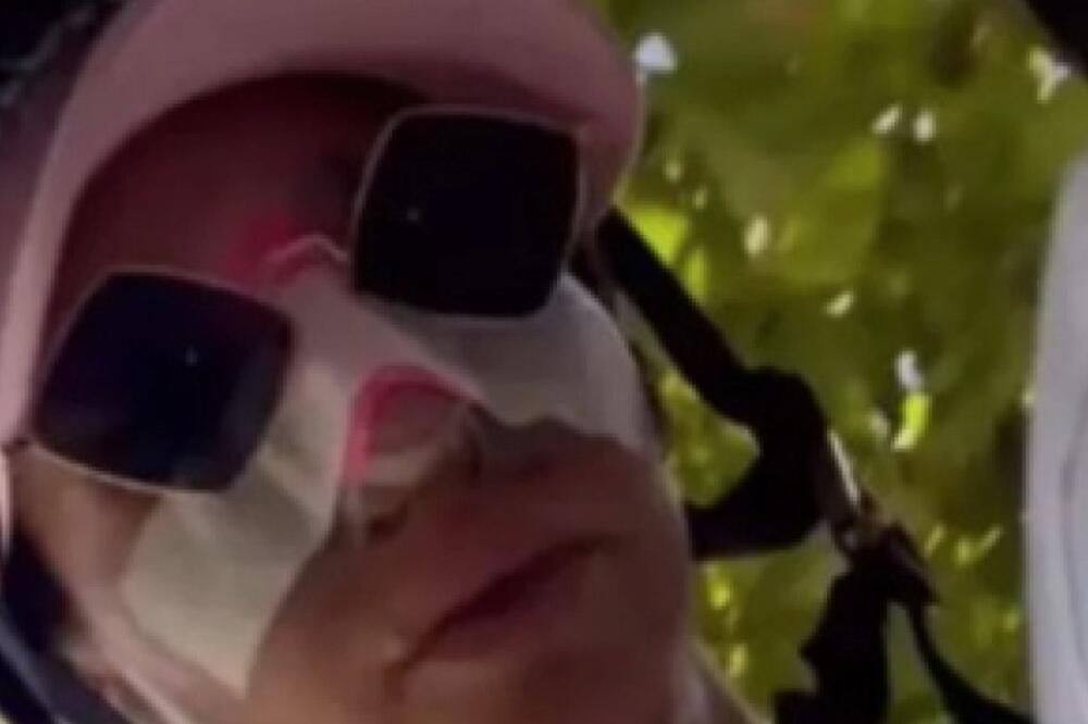 DELE SE SABLASNE SLIKE RIJALITI UČESNICE SA PINKA! Cela glava joj u podlivima, zna se i razlog