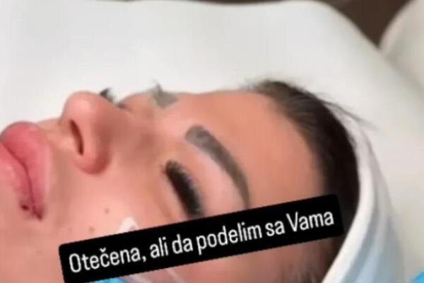 Miljana Kulić završila na operacionom stolu! Šok slike objavljene na mrežama, sva je...